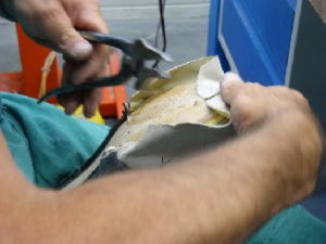 chaussure ortho montage Boucharenc