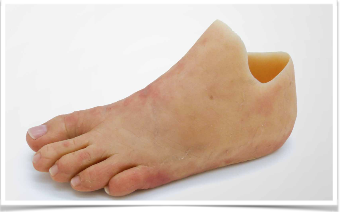 Pieds silicones & Prothèses de Pied sur-mesure - Boucharenc